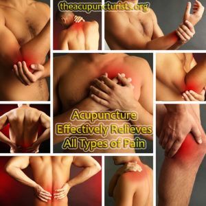 Acupuncture is effective for all types of pain conditions.