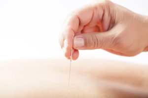 acupuncture reduces tension and stress