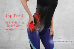 Acupuncture for Hip Pain in Coral Sorings, Margate and Coconut Creek Florida