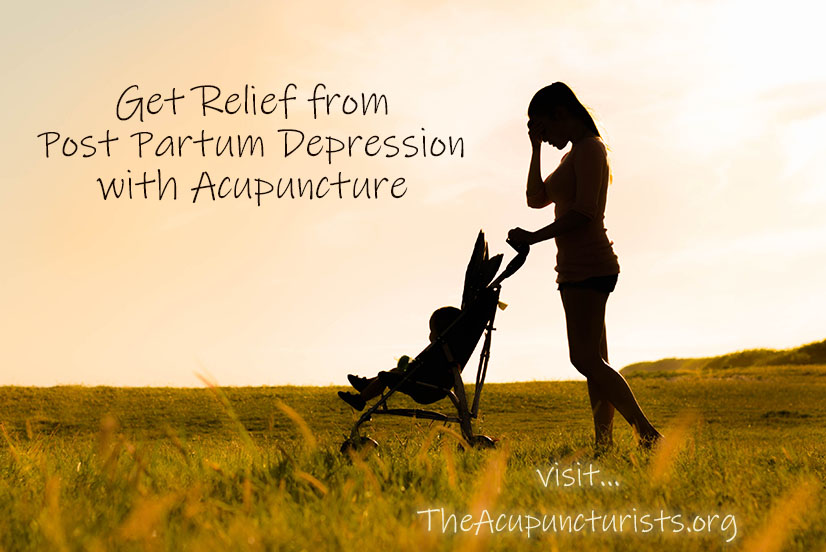 Acupuncture for Post Partum Depression in Coral Springs, Coconut Creek and Margate Florida