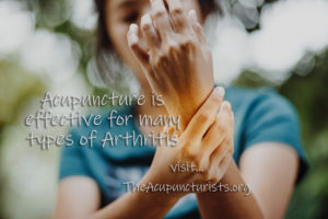 Acupuncture for Arthritis in Margate, Coral Springs, Coconut Creek Florida