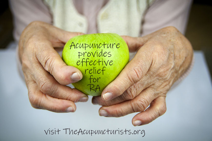 Acupuncture is an effective treatment for Rheumatoid Arthritis in Margate, Coral Springs and Coconut Creek